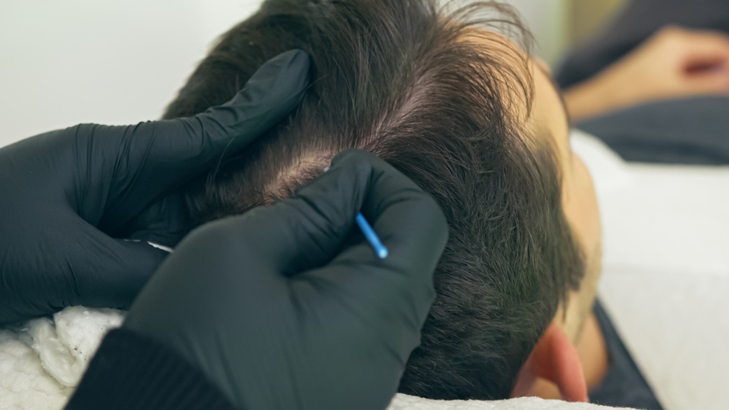Nahaufnahme des Kopf eines Mannes während einer Haarbehandlung